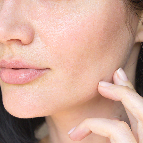 The Up Thread Lift that Slims Down Your Jawline Thumbnail