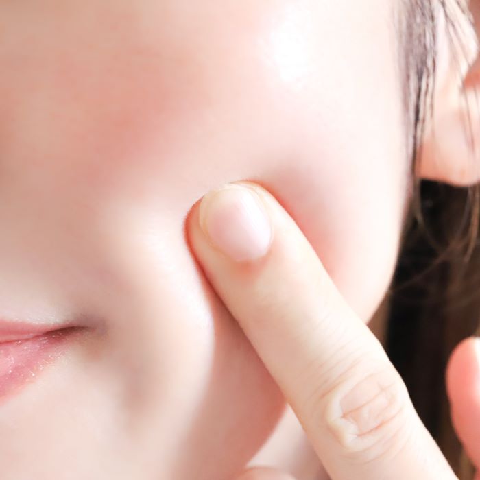 Hiệu Quả Của Thủ Thuật Tiêm Skinvive Được Duy Trì Bao Lâu? Thumbnail