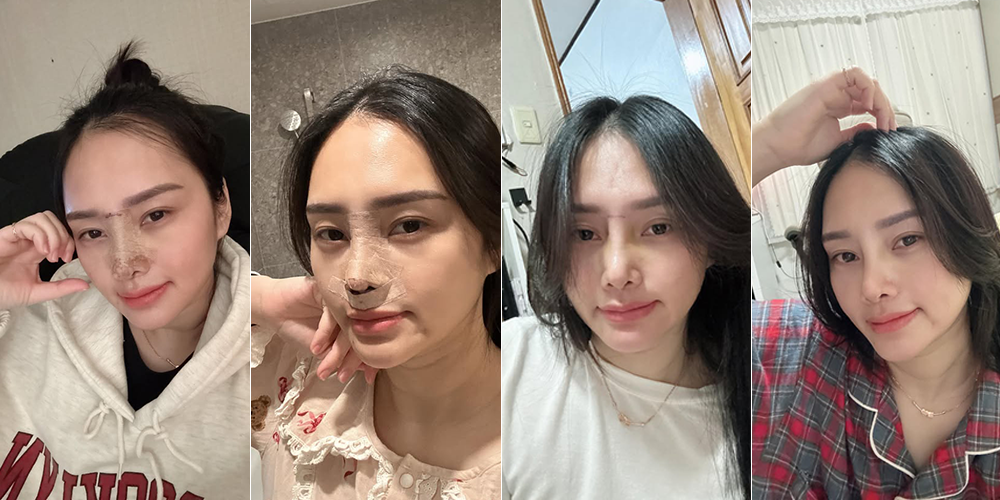 쉬즈성형외과, 부산성형외과, 부산, 남포동성형외과