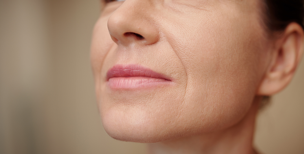 嘴角和下頜線的鬆弛和皺紋要怎麼改善呢？